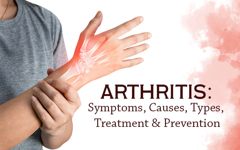 Arthritis: Symptoms, Causes, Types, Treatment & Prevention - Healing ...